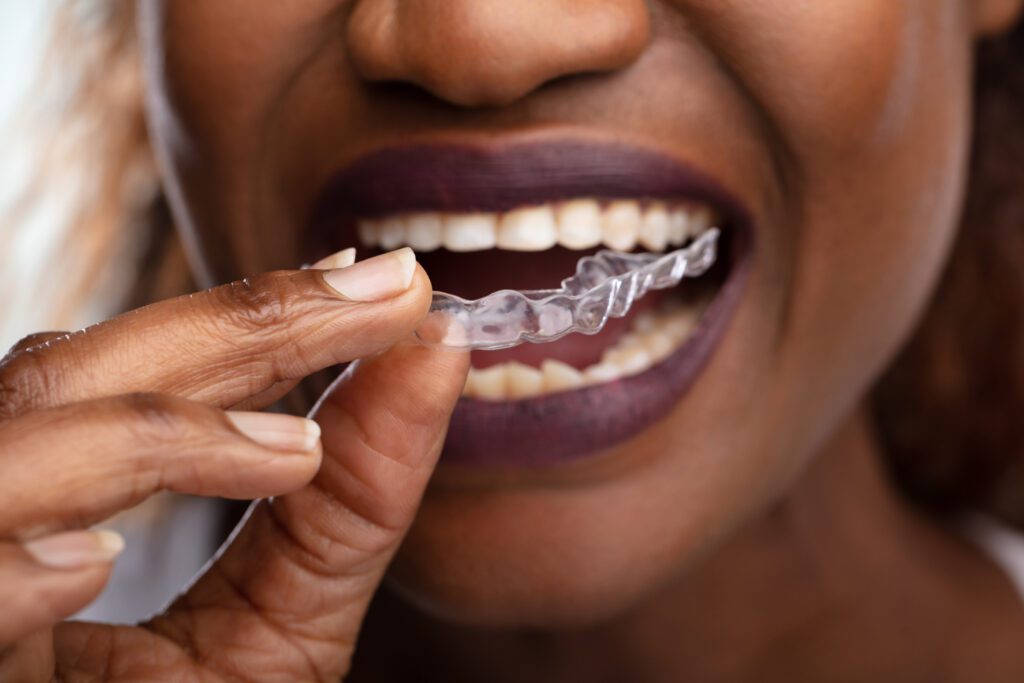 Invisalign in Carrollton, TX