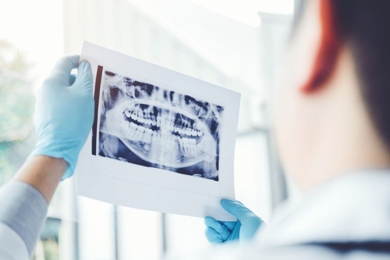 Why Get a Dental X-Ray
